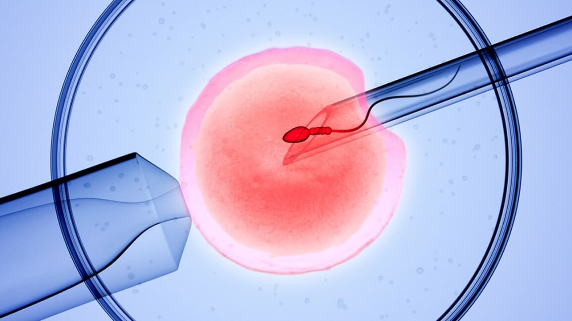 Intrauterine Insemination (IUI)